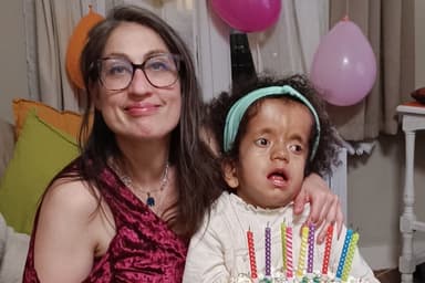 Hydrocéphalie | Un traitement inventé à Montréal bientôt mis à l’essai